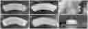 Fig. 01 - Bioprinted meniscus implant and methods of using same