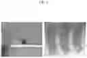 Fig. 06 - Bioprinted meniscus implant and methods of using same