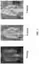 Fig. 08 - Implants having a drug load of an oxysterol and methods of use