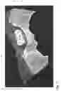 Fig. 03 - Biocompatible molded part