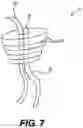 Fig. 08 - WOUND TREATMENT DEVICE