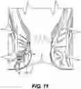 Fig. 12 - WOUND TREATMENT DEVICE