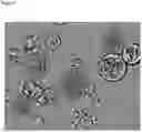 Fig. 06 - Degradable removable implant for the sustained release of an active compound