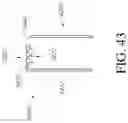 Fig. 85 - Negative pressure wound closure device