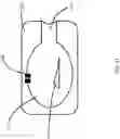 Fig. 11 - Negative pressure wound therapy apparatuses and methods for using the same
