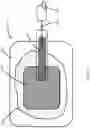 Fig. 14 - Negative pressure wound therapy apparatuses and methods for using the same