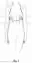Fig. 02 - Halter support device for use with lactation pump collection containers