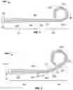 Fig. 02 - VARIABLE-STIFFNESS DISTAL EXTENSION FOR A BLOOD PUMP SYSTEM