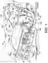 Fig. 02 - Method and apparatus for trending automated peritoneal dialysis treatments
