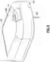 Fig. 03 - CATHETER INSERTION DEVICE AND METHOD OF INSERTING A CATHETER