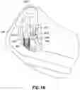Fig. 16 - CATHETER INSERTION DEVICE AND METHOD OF INSERTING A CATHETER