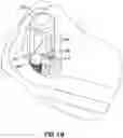 Fig. 19 - CATHETER INSERTION DEVICE AND METHOD OF INSERTING A CATHETER