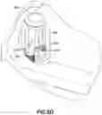 Fig. 20 - CATHETER INSERTION DEVICE AND METHOD OF INSERTING A CATHETER