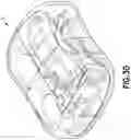 Fig. 30 - CATHETER INSERTION DEVICE AND METHOD OF INSERTING A CATHETER