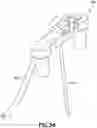Fig. 34 - CATHETER INSERTION DEVICE AND METHOD OF INSERTING A CATHETER