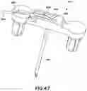 Fig. 47 - CATHETER INSERTION DEVICE AND METHOD OF INSERTING A CATHETER