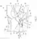 Fig. 03 - Delivery of therapeutic material via sub-ligamentous space