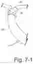 Fig. 22 - Delivery of respiratory therapy using collapsible inlet conduits