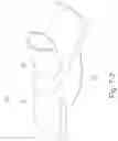 Fig. 23 - Delivery of respiratory therapy using collapsible inlet conduits