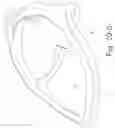 Fig. 33 - Delivery of respiratory therapy using collapsible inlet conduits