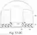 Fig. 49 - Delivery of respiratory therapy using collapsible inlet conduits