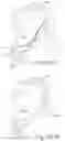 Fig. 64 - Delivery of respiratory therapy using collapsible inlet conduits