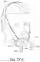 Fig. 68 - Delivery of respiratory therapy using collapsible inlet conduits