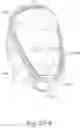 Fig. 69 - Delivery of respiratory therapy using collapsible inlet conduits