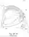 Fig. 72 - Delivery of respiratory therapy using collapsible inlet conduits