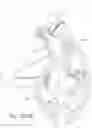 Fig. 75 - Delivery of respiratory therapy using collapsible inlet conduits