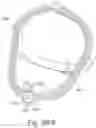 Fig. 79 - Delivery of respiratory therapy using collapsible inlet conduits