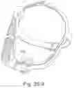 Fig. 80 - Delivery of respiratory therapy using collapsible inlet conduits