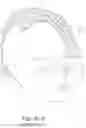 Fig. 82 - Delivery of respiratory therapy using collapsible inlet conduits