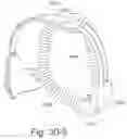 Fig. 85 - Delivery of respiratory therapy using collapsible inlet conduits