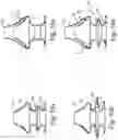 Fig. 48 - Compact oronasal patient interface