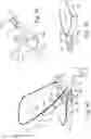 Fig. 55 - Compact oronasal patient interface