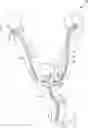 Fig. 01 - Ureteral and Bladder Catheters and Methods of Inducing Negative Pressure to Increase Renal Perfusion