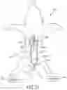 Fig. 25 - Ureteral and Bladder Catheters and Methods of Inducing Negative Pressure to Increase Renal Perfusion