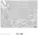 Fig. 28 - Ureteral and Bladder Catheters and Methods of Inducing Negative Pressure to Increase Renal Perfusion