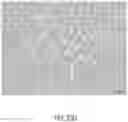 Fig. 30 - Ureteral and Bladder Catheters and Methods of Inducing Negative Pressure to Increase Renal Perfusion