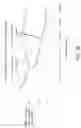 Fig. 33 - Ureteral and Bladder Catheters and Methods of Inducing Negative Pressure to Increase Renal Perfusion
