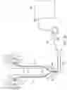 Fig. 35 - Ureteral and Bladder Catheters and Methods of Inducing Negative Pressure to Increase Renal Perfusion
