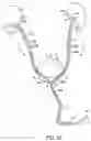 Fig. 46 - Ureteral and Bladder Catheters and Methods of Inducing Negative Pressure to Increase Renal Perfusion