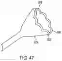 Fig. 52 - Ureteral and Bladder Catheters and Methods of Inducing Negative Pressure to Increase Renal Perfusion