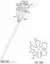 Fig. 57 - Ureteral and Bladder Catheters and Methods of Inducing Negative Pressure to Increase Renal Perfusion