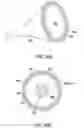 Fig. 58 - Ureteral and Bladder Catheters and Methods of Inducing Negative Pressure to Increase Renal Perfusion
