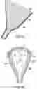 Fig. 59 - Ureteral and Bladder Catheters and Methods of Inducing Negative Pressure to Increase Renal Perfusion