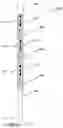 Fig. 06 - Magnetically controlled medical devices for interventional medical procedures and methods of making and controlling the same