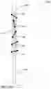 Fig. 13 - Magnetically controlled medical devices for interventional medical procedures and methods of making and controlling the same