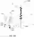 Fig. 15 - Magnetically controlled medical devices for interventional medical procedures and methods of making and controlling the same